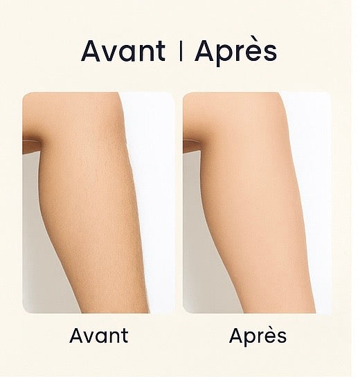 Épilateur IPL - Appareil d’Épilation à Lumière Pulsée